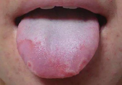 2023寧波耳再造耳修復(fù)排行前十名專家(雷艷莉、何祥輝、姚建民是正規(guī)嗎？屬于幾級(jí))