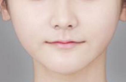 哪個(gè)整形醫(yī)生在審美在線中備受贊譽(yù)？黃惠真、韓國(guó)棟、陳玉連在鼻部整形領(lǐng)域彰顯實(shí)力