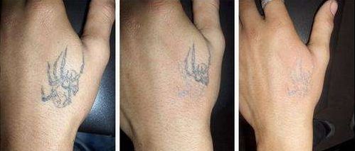 商丘市整容醫(yī)院哪家好？綜合評(píng)價(jià)一覽，找到適合您的理想之選！