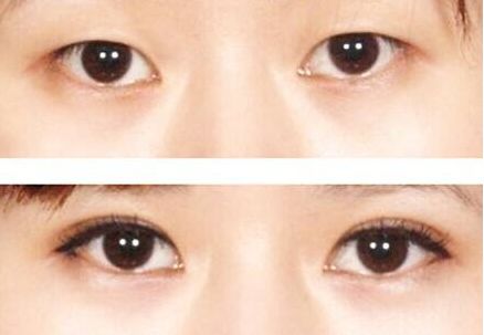 榆林市美容哪家醫(yī)院好？榆林市頂級美容醫(yī)院推薦