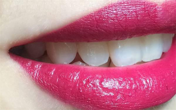 2023上海嗨體去眼角紋排名top10強專家(鄔宗周、周汝真、楊春梅排上名號)