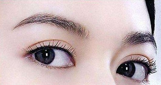 深圳哪家醫(yī)院的雙眼皮手術效果好？