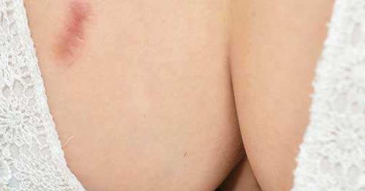 山東小陰唇手術(shù)哪家正規(guī)專業(yè)值得選擇？