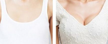 上海抽脂整形醫(yī)院排名2023：哪家好且性價(jià)比更高？