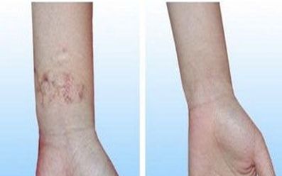 濟寧去雀斑醫(yī)院哪家好？揭秘濟寧市治療雀斑效果最好的醫(yī)院