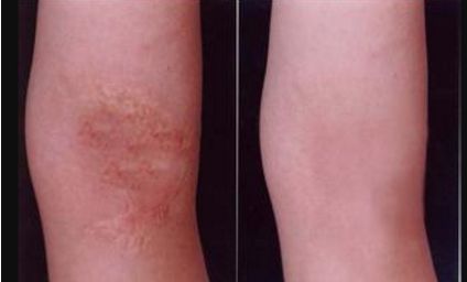 河北雙眼皮手術(shù)哪家好？挑選專業(yè)技術(shù)與良好口碑并存的醫(yī)療機構(gòu)！