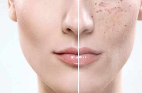 福建泉州海峽醫(yī)療美容醫(yī)院怎么樣？福建泉州海峽醫(yī)療美容醫(yī)院簡介|醫(yī)生團(tuán)隊|口碑評價！