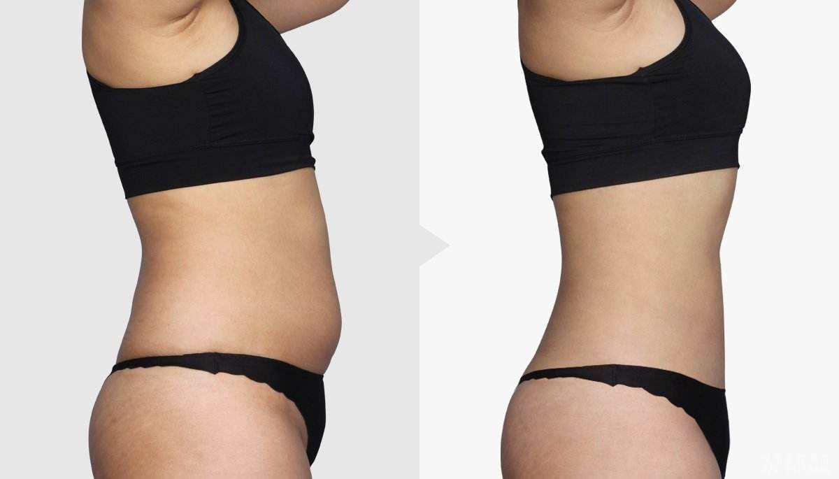 2023黃石玻尿酸原液正規(guī)醫(yī)生評分前幾(彭靜、楊天赤、步長龍等都是不錯的醫(yī)生！)