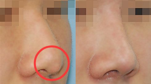 福州哪家醫(yī)院做疤痕好？比較全面的福州疤痕治療醫(yī)院推薦給您！