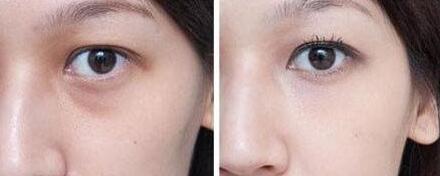 同濟(jì)吳毅平醫(yī)生：擅長面部年輕化，口碑怎么樣？同濟(jì)吳毅平醫(yī)生，技術(shù)高超面部年輕化效果顯著