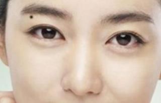 認識眼部大咖，探索秦宏偉醫(yī)生的簡介及雙眼皮案例分享