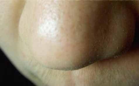 2023長春假體墊鼻基專家上榜名單前十強(qiáng)(趙雯、唐愛東、黃慶吉實(shí)力正規(guī)靠譜)