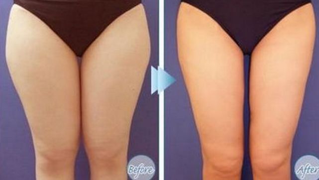 大連專業(yè)祛斑哪家醫(yī)院好？祛斑效果最好的醫(yī)院有哪些？