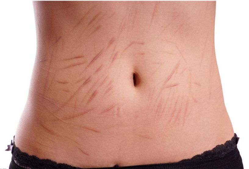 南京抽脂手術(shù)那家醫(yī)院技術(shù)靠譜？哪家醫(yī)院的抽脂效果好？