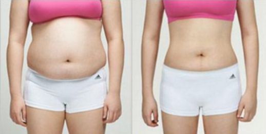 南昌哪家醫(yī)院的吸脂效果好？