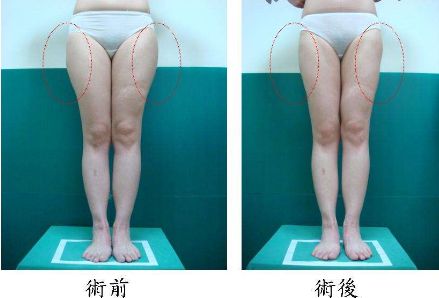 昆明哪家治痘痘好的醫(yī)院，痘痘問題如何有效解決？