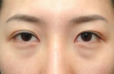 杭州面部提升醫(yī)生和專業(yè)醫(yī)院介紹，了解小拉皮技術(shù)好的醫(yī)生