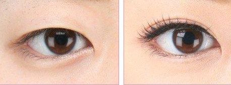 上海哪家醫(yī)院做處女膜修復(fù)好？