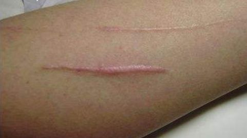 上海韓嘯醫(yī)療美容醫(yī)院的豐胸技術(shù)靠譜嗎？