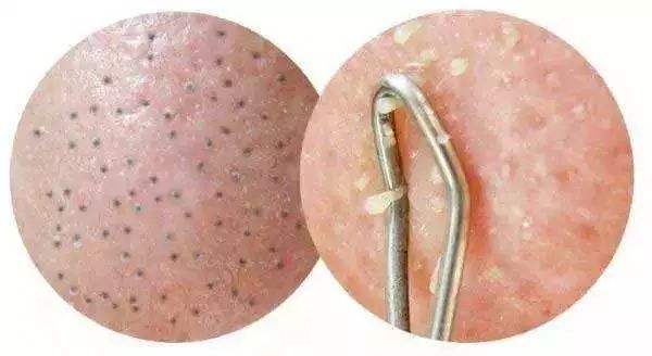 2023長春無痕動態(tài)隆胸醫(yī)生排名榜前幾(尤海濱、王隆潔、劉志靜正規(guī)大牌權(quán)威一覽)