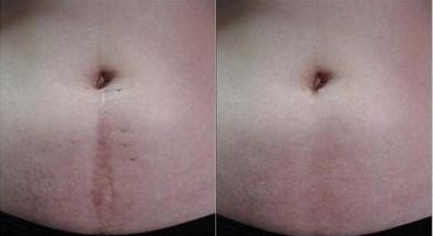 宜昌眼科醫(yī)院哪家好，專業(yè)眼科醫(yī)生助您解答