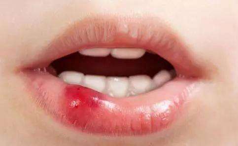 2023銅仁治療酒糟鼻top10強(qiáng)的專家(肖鈺柱、劉大琨、龔武斌從評(píng)價(jià)看挺正規(guī))