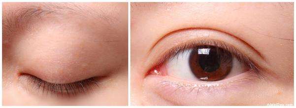 2023昆明隔空溶脂瘦肩部醫(yī)生top10強(qiáng)排名(李明、唐欽、任德浩榜首屬實(shí)意外)