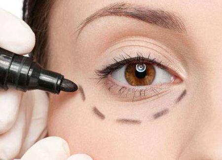 蘇州哪位醫(yī)生修復(fù)雙眼皮失敗靠譜？案例分享有人氣！