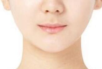 上海第九人民醫(yī)院李圣利：坐診時間、醫(yī)生簡介與雙眼皮案例介紹