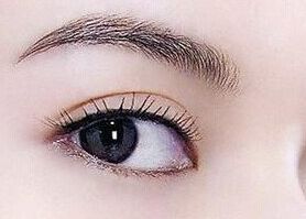 南充去眼袋哪家醫(yī)院好？專家推薦解決眼袋困擾的南充醫(yī)院排行榜