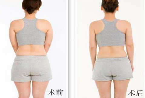 洛陽雙眼皮好的醫(yī)院有哪些？