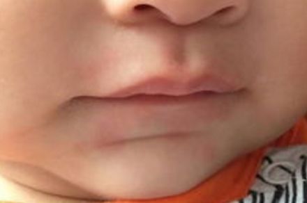 天津星和醫(yī)療美容門診怎么樣？天津星和醫(yī)療美容門診簡介|醫(yī)生團(tuán)隊|口碑評價！