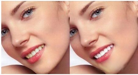 樸正國正頜手術(shù)有哪些風(fēng)格審美？