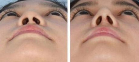 衢州做小手術(shù)哪家醫(yī)院好？快速推薦衢州當(dāng)?shù)貙I(yè)的醫(yī)院