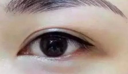 福州秀清醫(yī)療美容整形醫(yī)院的資質(zhì)和口碑怎么樣？