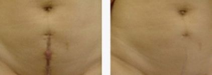 深圳私密整形醫(yī)院哪家好？讓我們來為您推薦最佳選擇