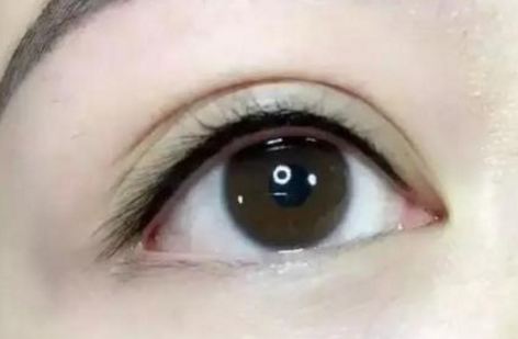 馬桂娥面頰填充脂肪能打造自然輪廓，挺陽高效！醫(yī)生背景介紹必讀！