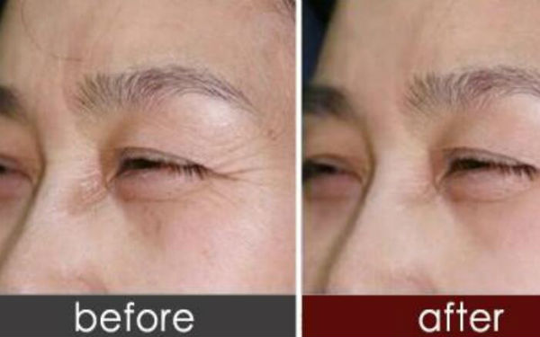 上海肋骨鼻哪位專家技術(shù)過硬？人氣牛仔鼻醫(yī)生排名大曝光！