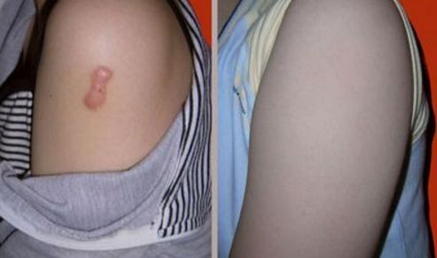 長春整形醫(yī)院哪家好？排名靠前的長春市好的整形醫(yī)院推薦