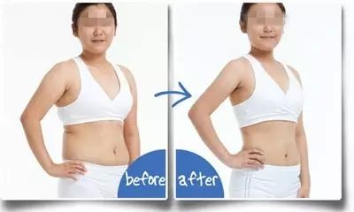 2023成都抽脂隆胸整形上榜清單前十名專家(秦曉、鄧兵、賈映缽價(jià)格不貴口碑好)