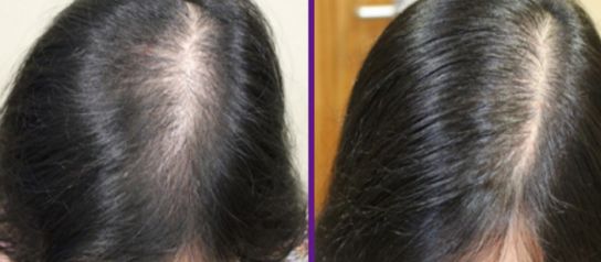 重慶小臂抽脂醫(yī)院排行榜TOP10，專業(yè)技術(shù)解析！