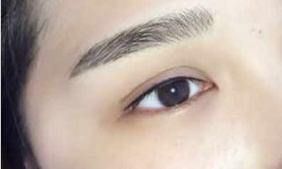 北京有口碑非常好的整形醫(yī)生推薦，綜合評分高，做吸脂效果優(yōu)異的名醫(yī)TOP5