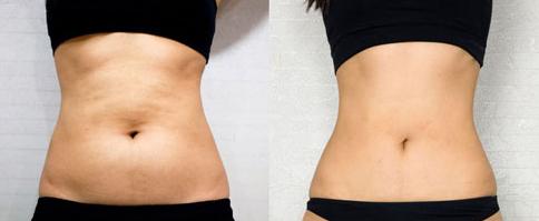 杭州藝星人氣專家鐘冠鴻：點石成金，輕松實現(xiàn)迷人鼻子，重磅價格表釋放！