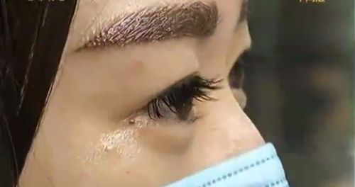 武漢招風耳矯正哪家好？尋找專業(yè)耳部矯正專家的最佳選擇