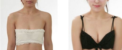 大連市做雙眼皮哪家好？了解大連市雙眼皮手術(shù)的費(fèi)用、效果和口碑