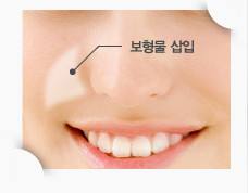 九院劉陽直接過去有聯(lián)系方式嗎？緊縮手術(shù)效果如何？醫(yī)生資料+價(jià)格概覽一目了然