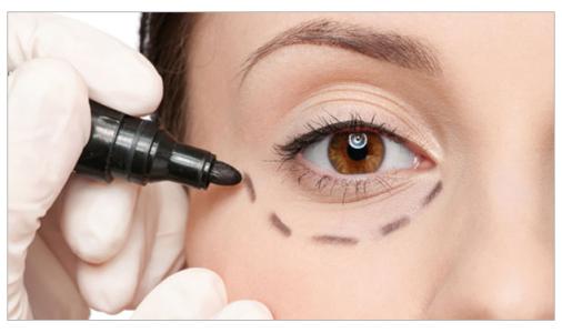 朱焱焱醫(yī)生：激光祛斑案例分享，告別煩惱，重現(xiàn)肌膚光彩