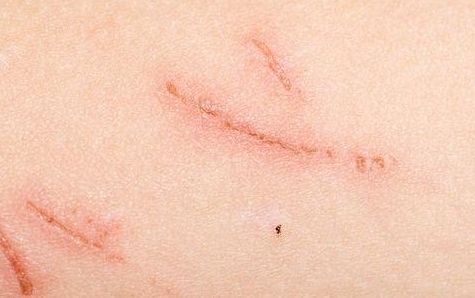 南陽市拉皮除皺手術(shù)哪家好？選擇何種醫(yī)院更安心？