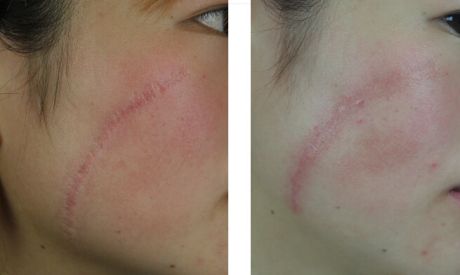 鄭州眼部整形哪家醫(yī)院好？醫(yī)生經(jīng)驗(yàn)與患者口碑共推薦！