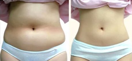 上海哪家醫(yī)院做美容手術好？——選擇上海做美容手術醫(yī)院的首選方案